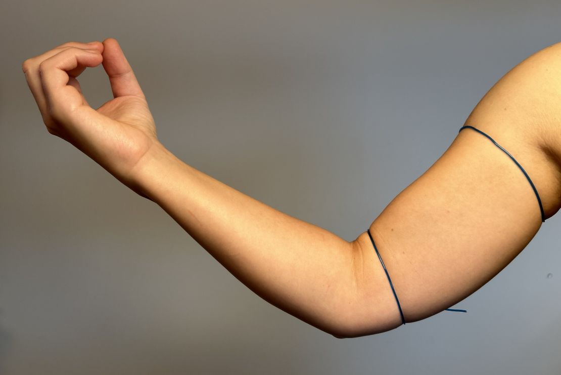 IMG_0573 Cathego Cathego cover for PICC, Midline, other catheters, dressings - measurement instructions